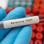 Norovirus Kawasaki e i suoi sintomi