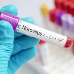 Gastroenterite da norovirus