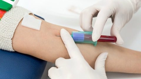 Quali malattie possiamo prevedere dagli esami del sangue?